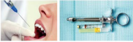 胰島素，牙科麻醉6.png